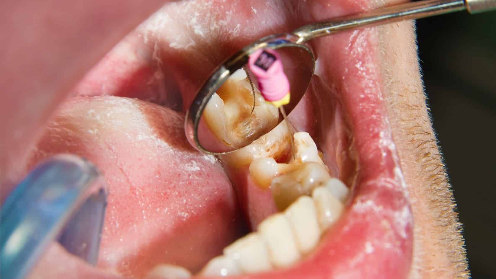 endodonti bölümü