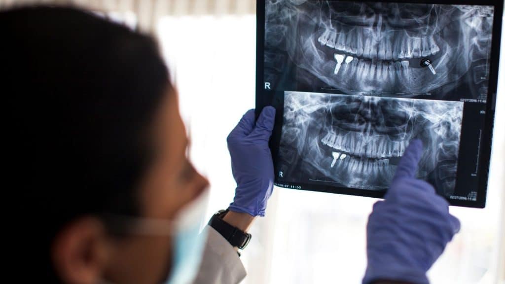 implant tedavi süreci