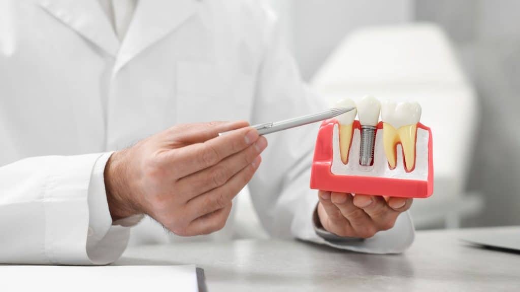 implant tedavi süreci