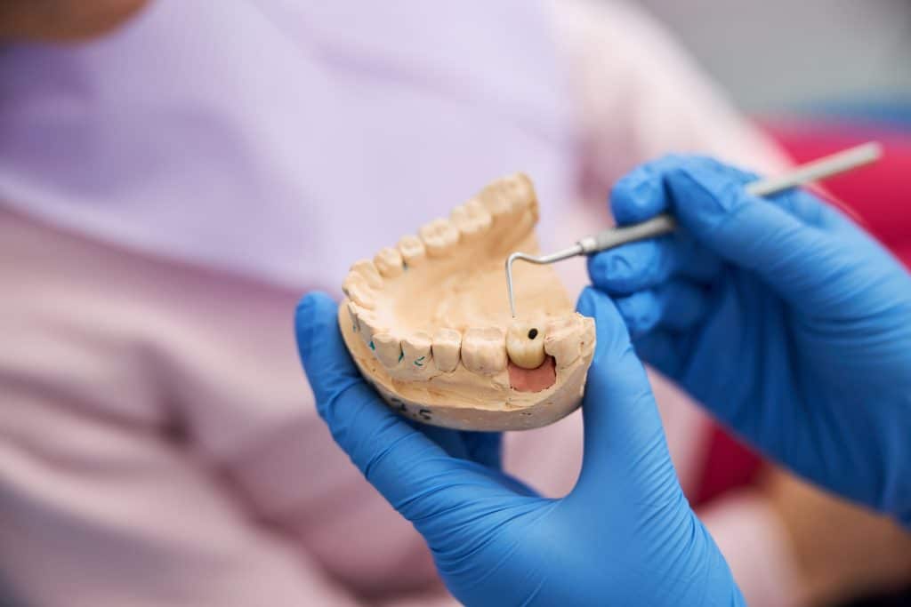 implant diş köprüsü anlatımı